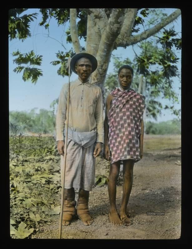 1899art Native King Wiith Elephantiasis Liberia Handcolored 1900s 1899art. Historical photograph from the 1899art Archive.